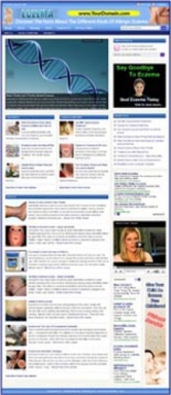 Product picture Eczema Website plr